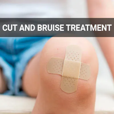 Visit our Cut and Bruise Treatment page
