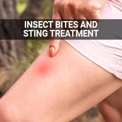 Visit our Insect Bites and Sting Treatment page