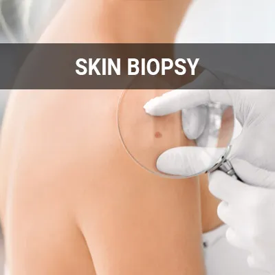 Visit our Skin Biopsy page