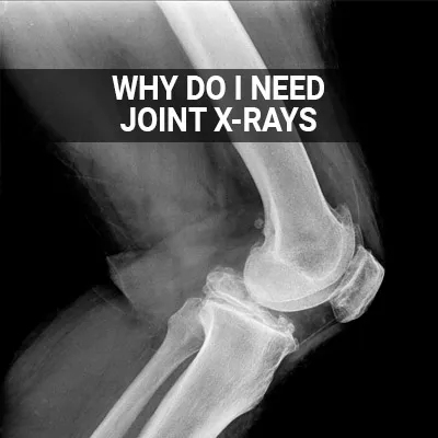Visit our Why Do I Need Joint X-Rays page