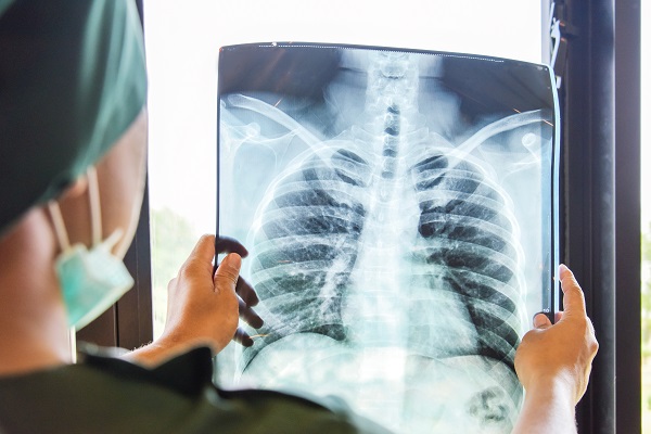 Signs You May Need An X Ray